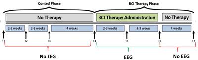 Ipsilesional Mu Rhythm Desynchronization and Changes in Motor Behavior Following Post Stroke BCI Intervention for Motor Rehabilitation